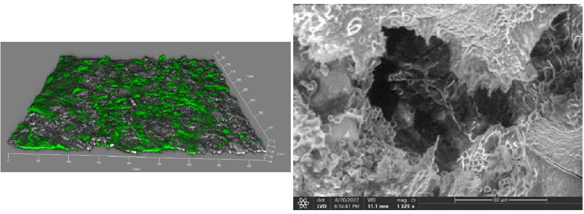  多孔镍钛合金的细胞相容性研究